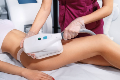 cryolipolysis fat freeze for thighs